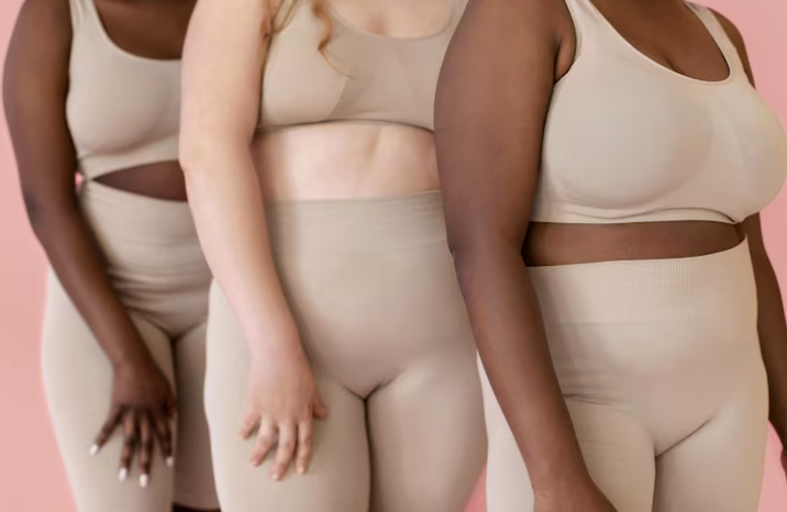 Lipedema